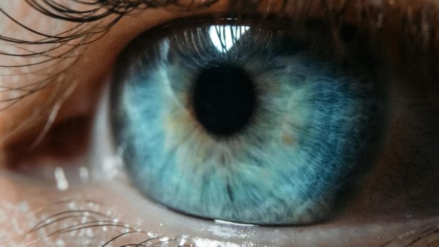 Cheratocono: Cause, Sintomi, Trattamenti e Consigli Pratici